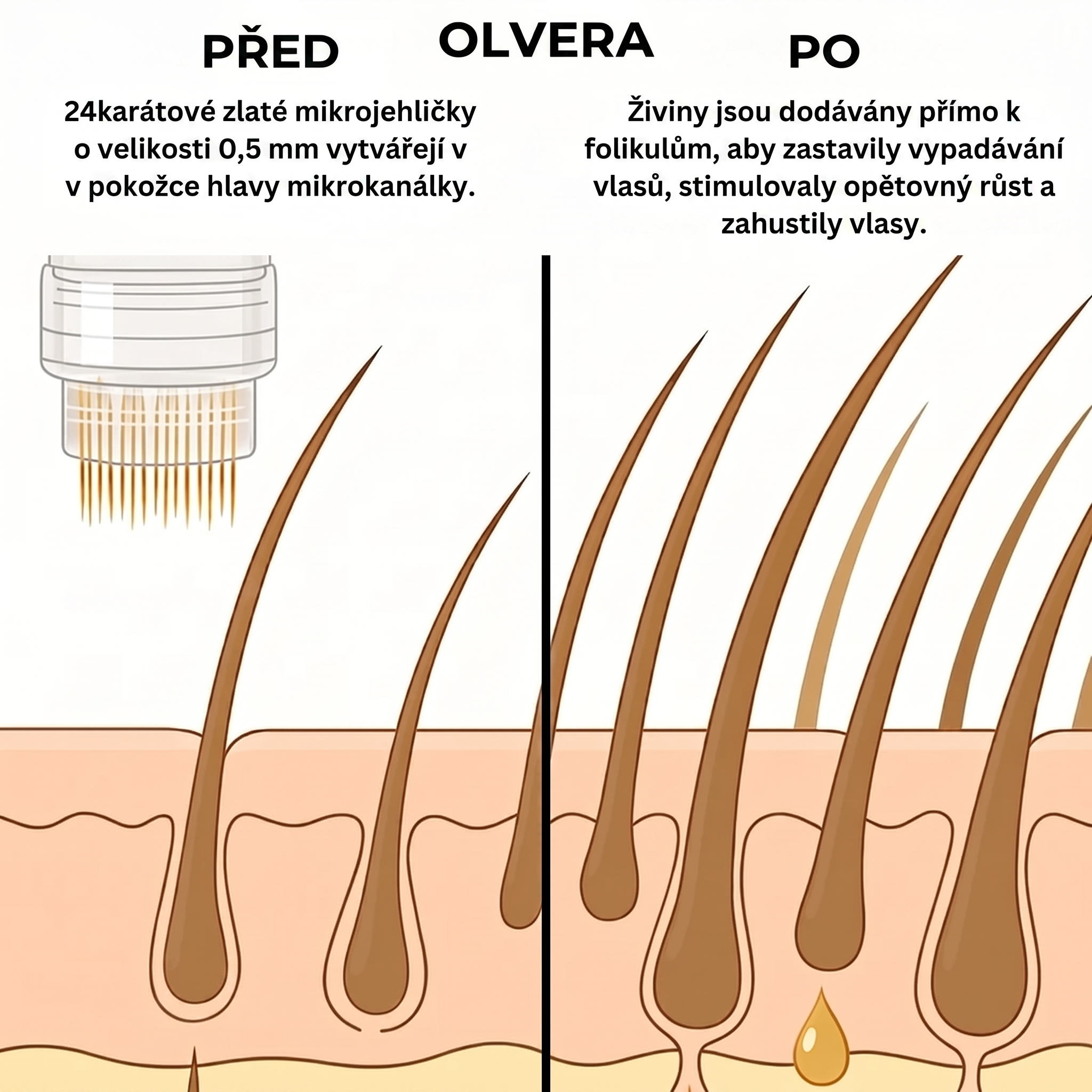 Vlasová Technologie Micro-infuse® pro Muže